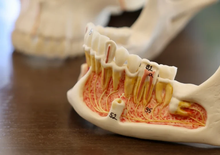 root canal vs dental implant