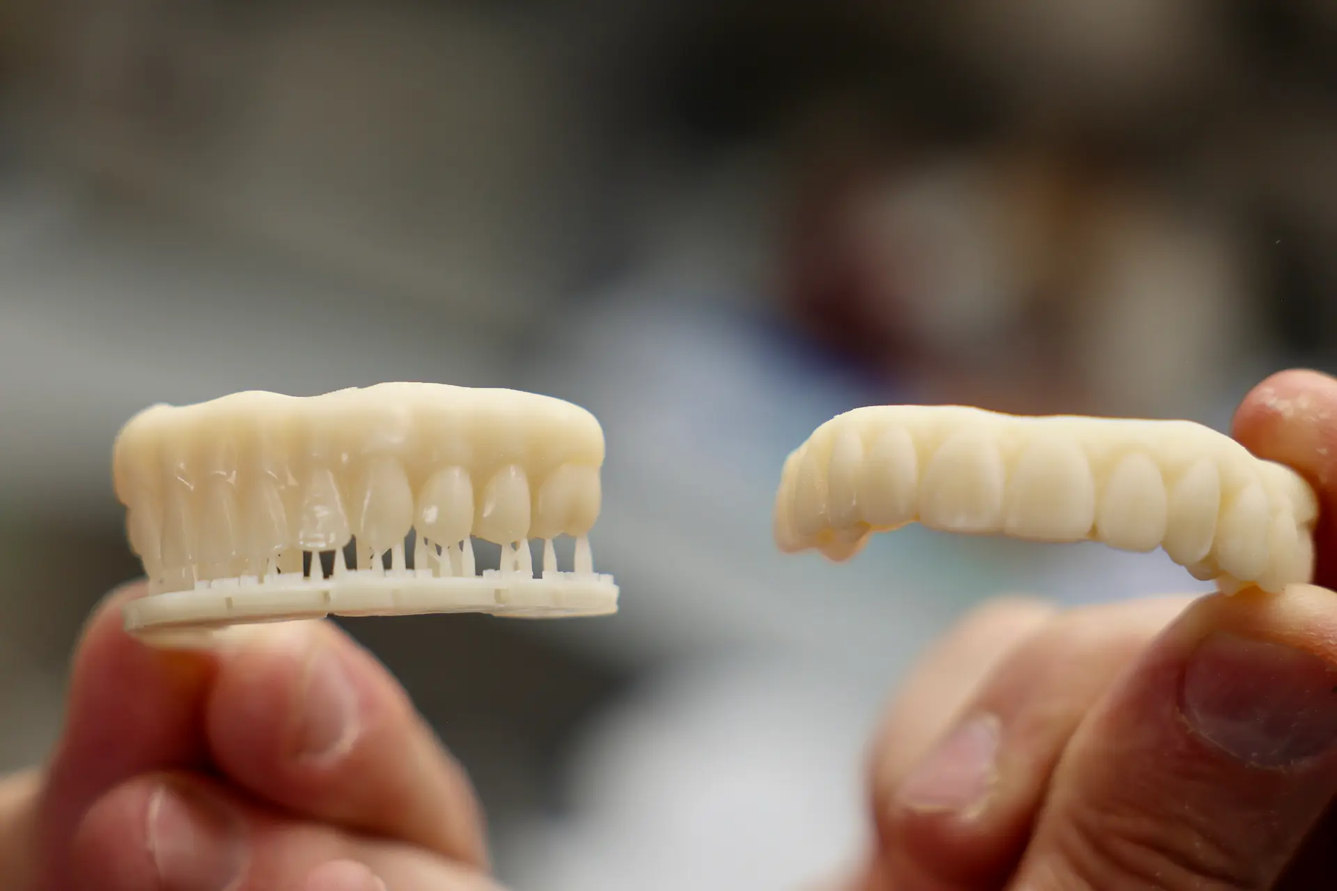 Permanent Dentures vs. Dental Implants